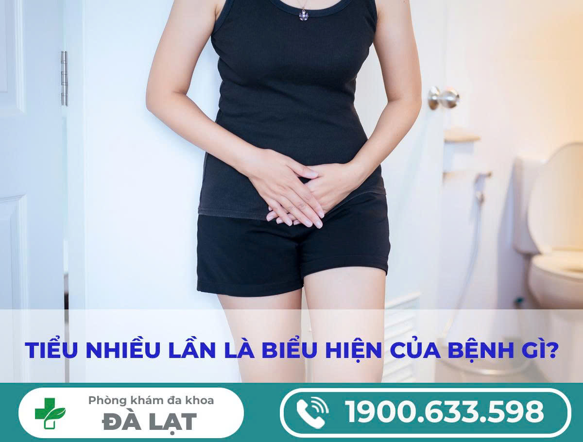 Hình ảnh minh họa